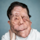 Adam Pearson Net Worth