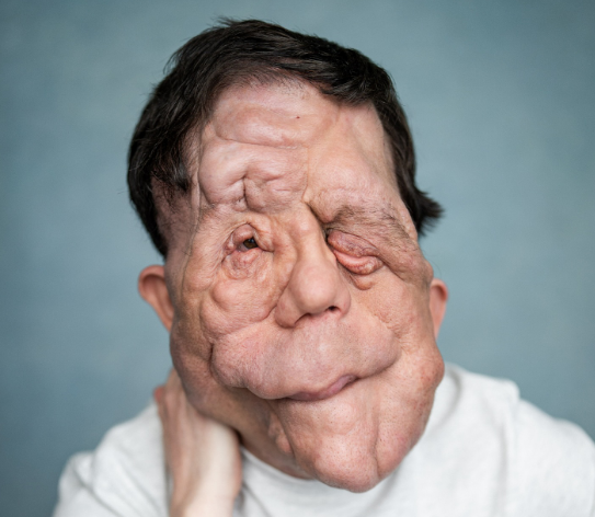 Adam Pearson Net Worth